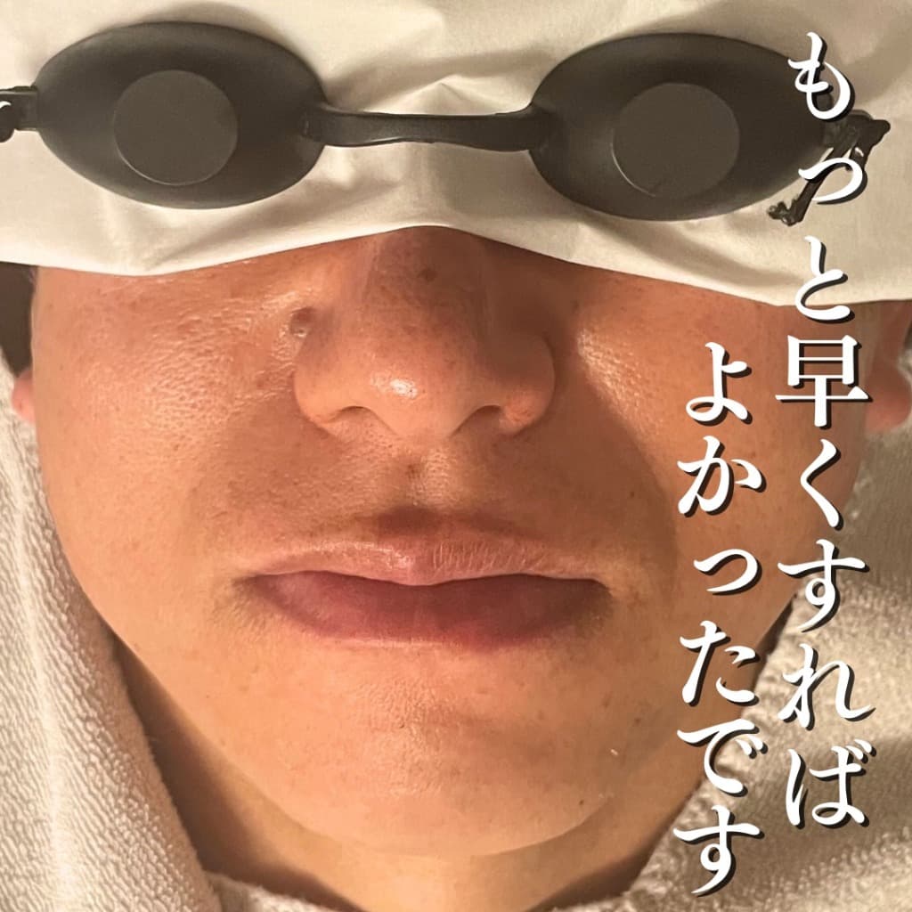 ヒゲ脱毛 施術後のイメージ（お客様の声）